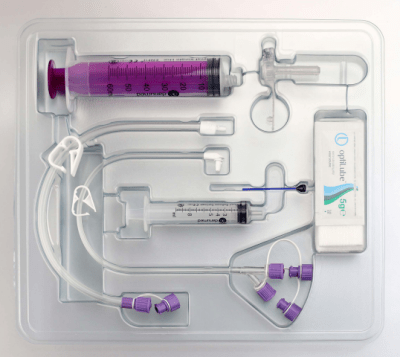 Botón de Gastrostomía Set