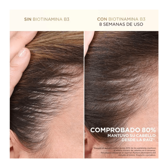 Shampoo Pantene Biotinamina B3 Anticaída & Nutrición 300 ml.3
