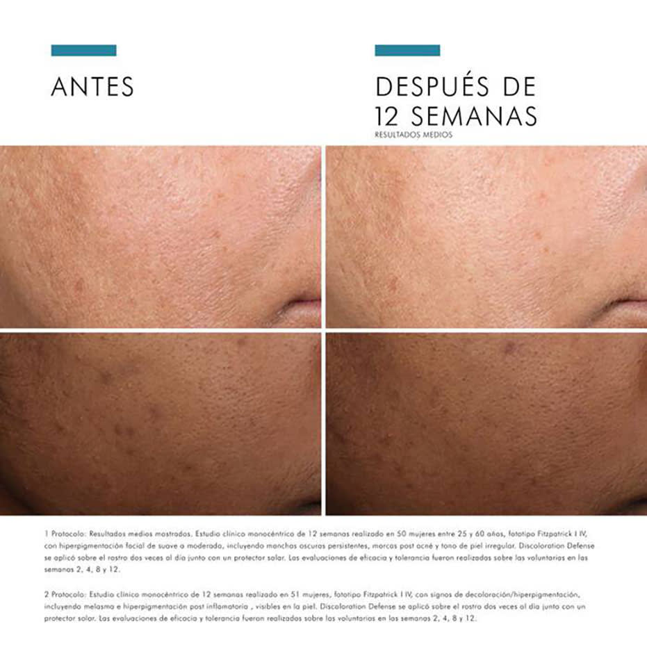 Discoloration Defense 30ml - SkinCeuticals5