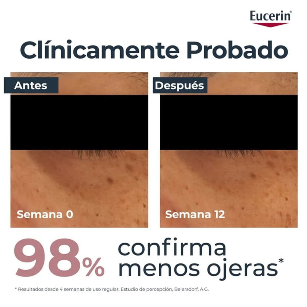 EUCERIN ANTI-PIGMENT CONTORNO DE OJOS CREMA X 15ML2