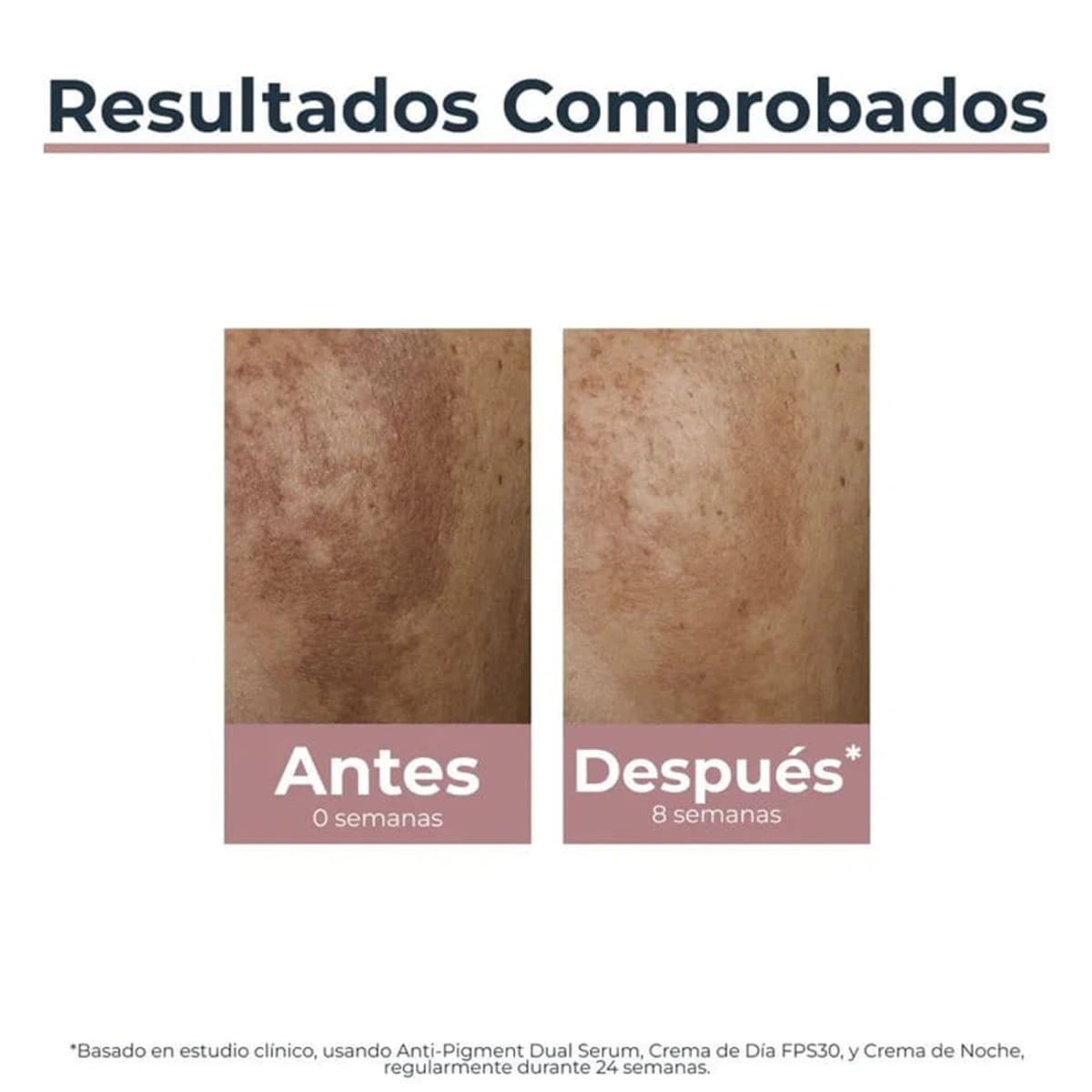 EUCERIN ANTIPIGMENTO CREMA DIA X 50ML4