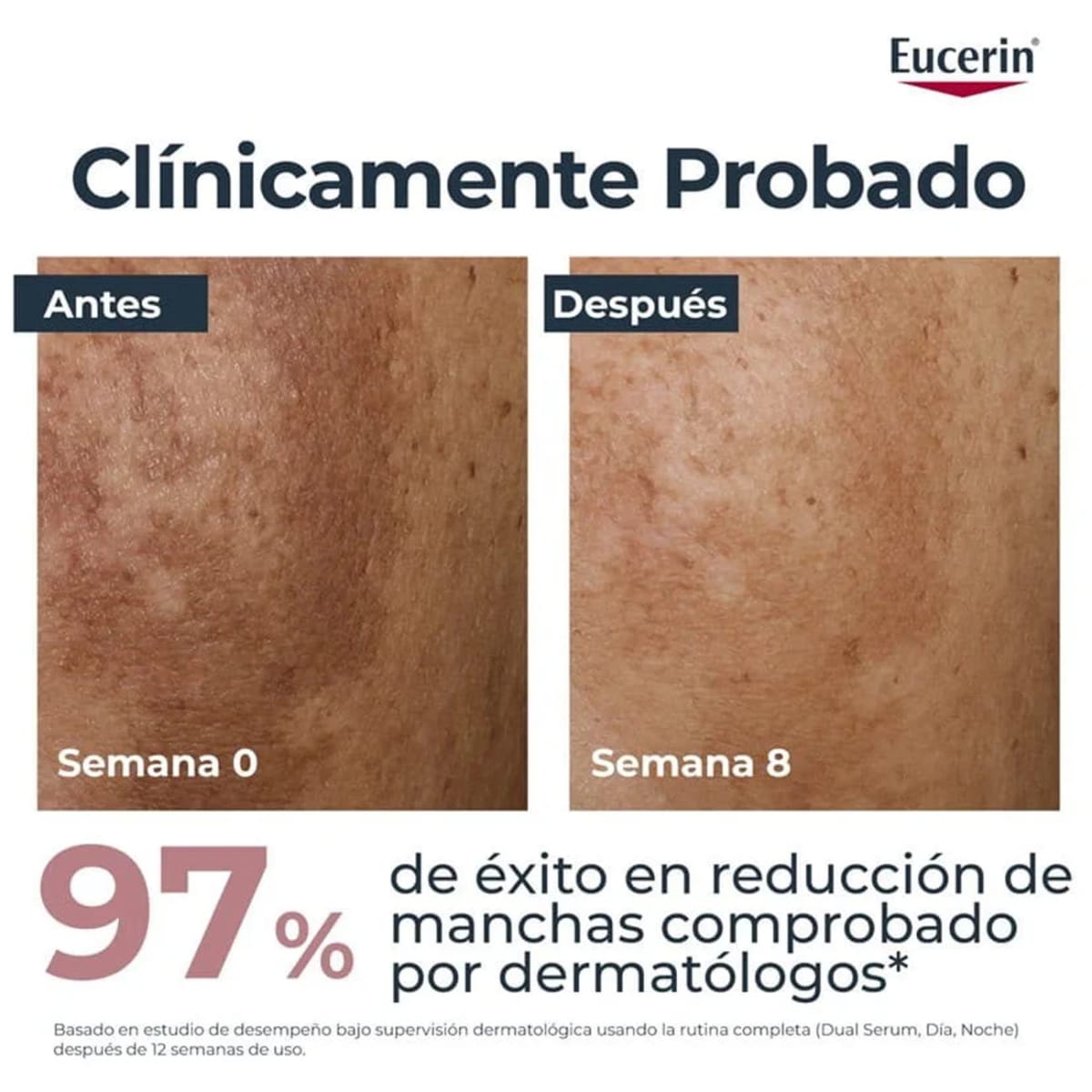 EUCERIN ANTIPIGMENTO SERUM FACIAL CLAREADOR DUAL 30ML2