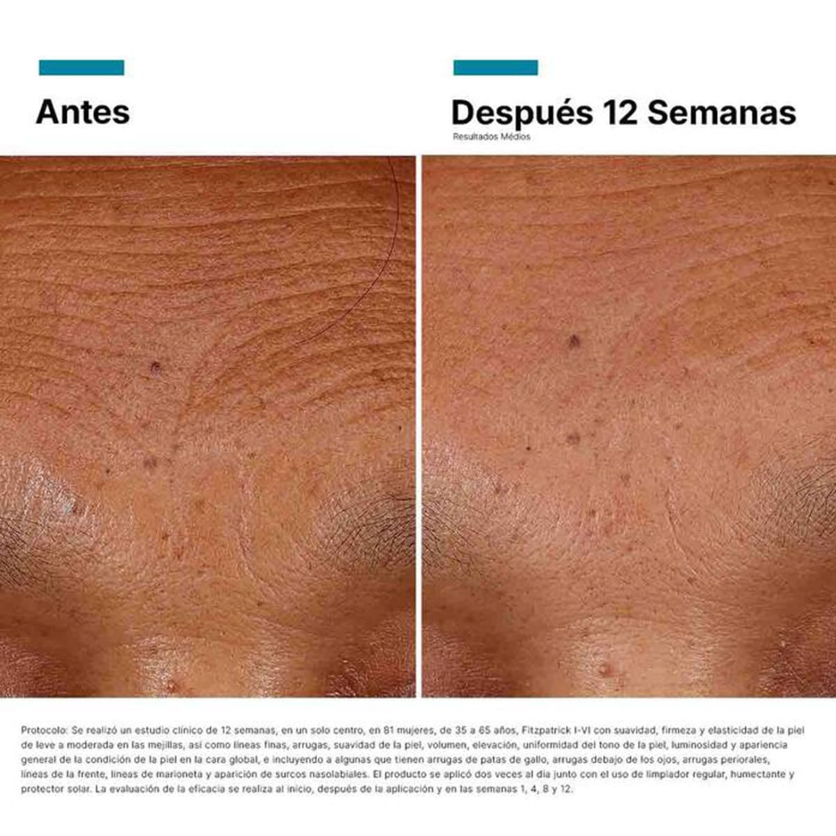 HA Intensifier Multi-Glycan 30ml - SkinCeuticals11