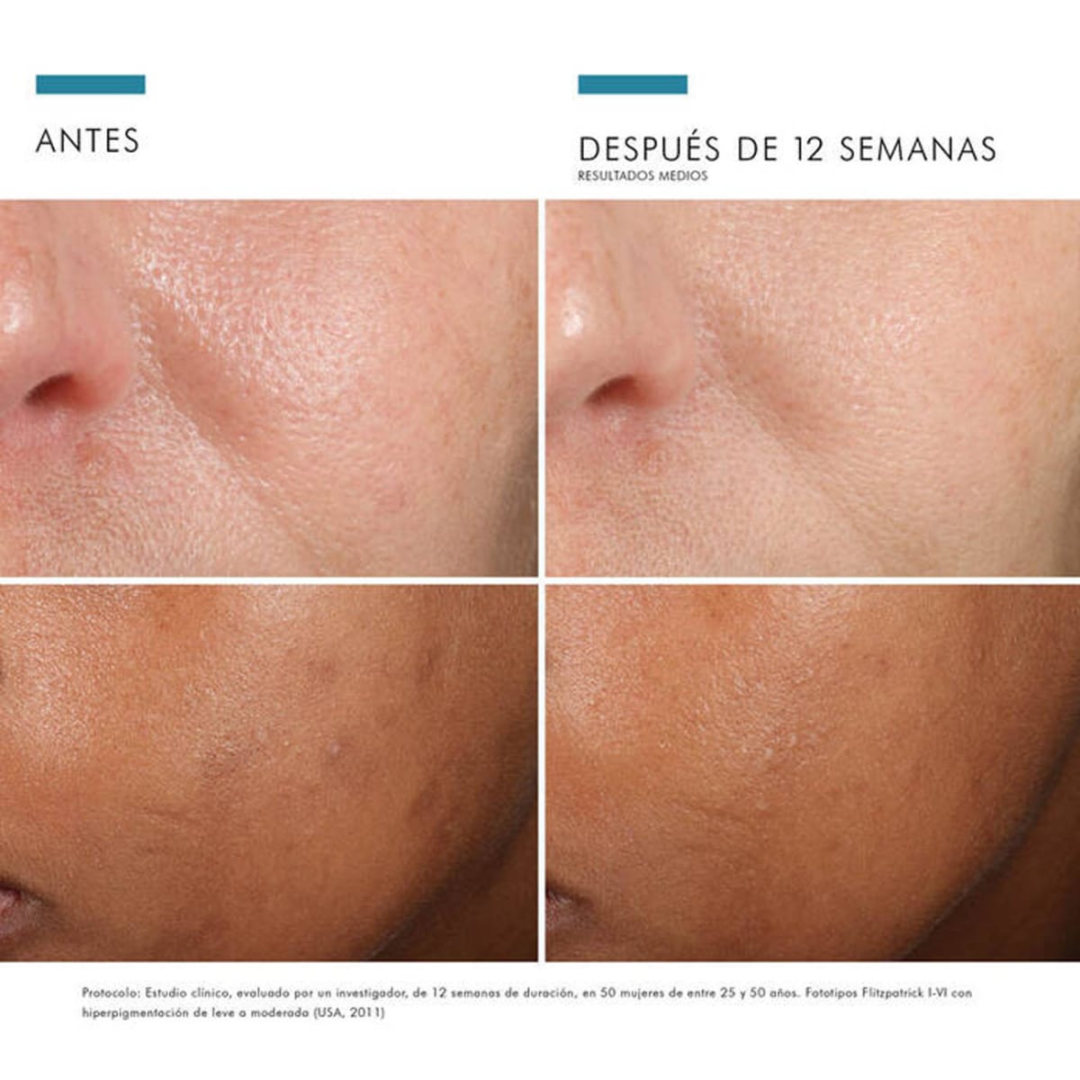 Phloretin CF Serum 30ml - SkinCeuticals5