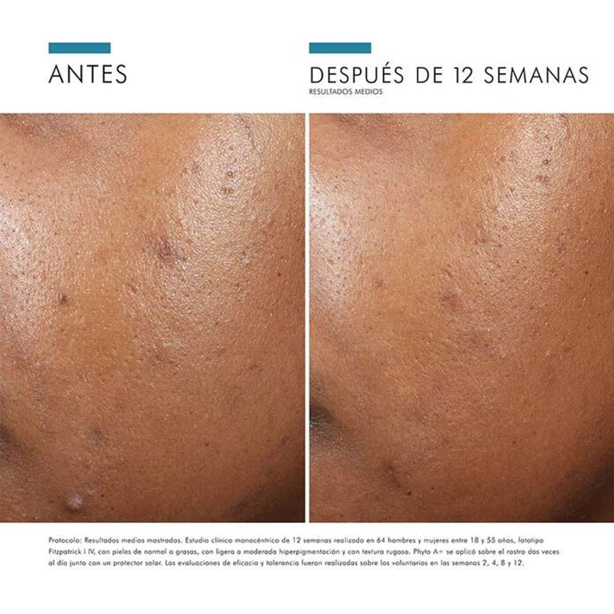 Phyto A+ Brightening Treatment 30ml - SkinCeuticals5