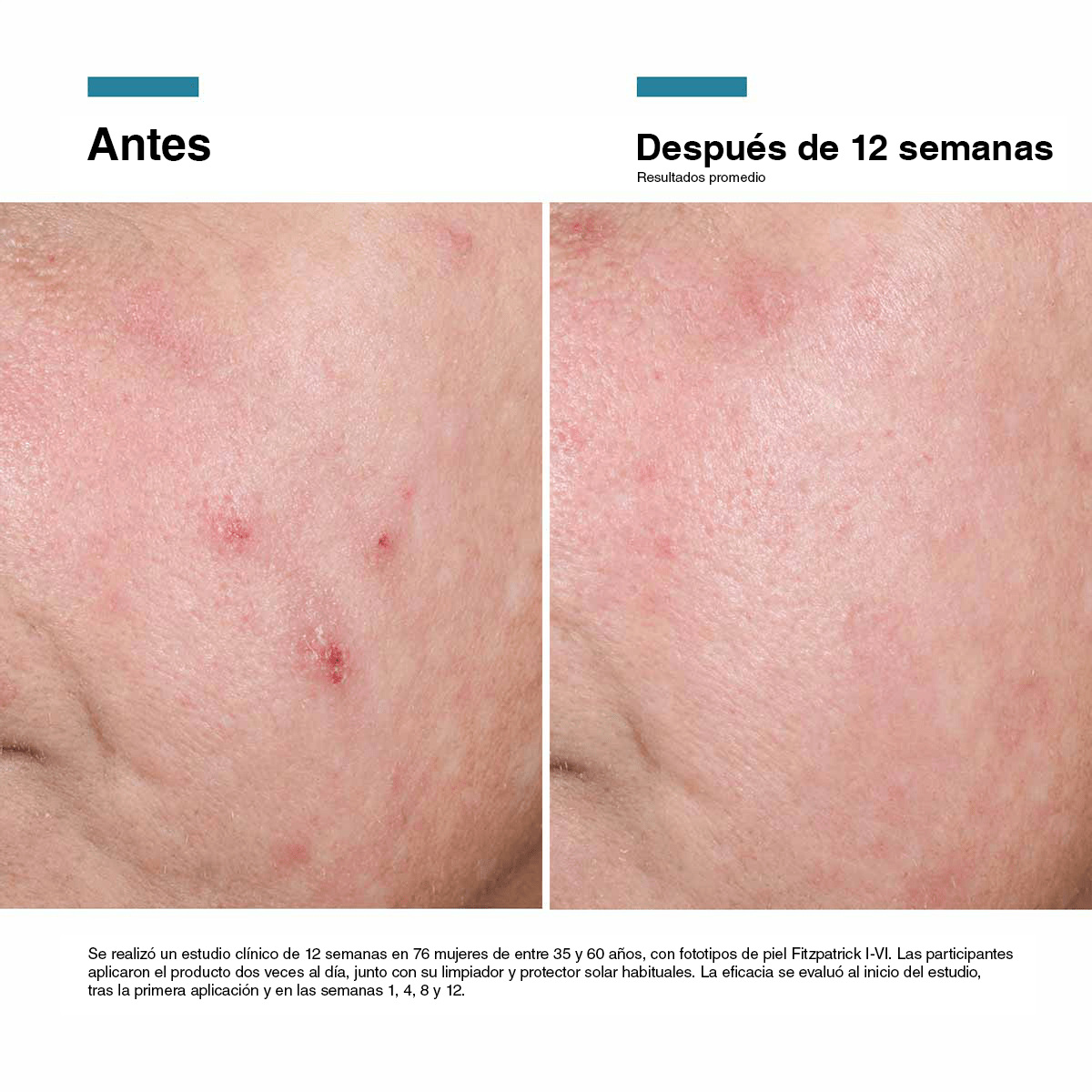 Advanced RGN-6 50ml - SkinCeuticals2