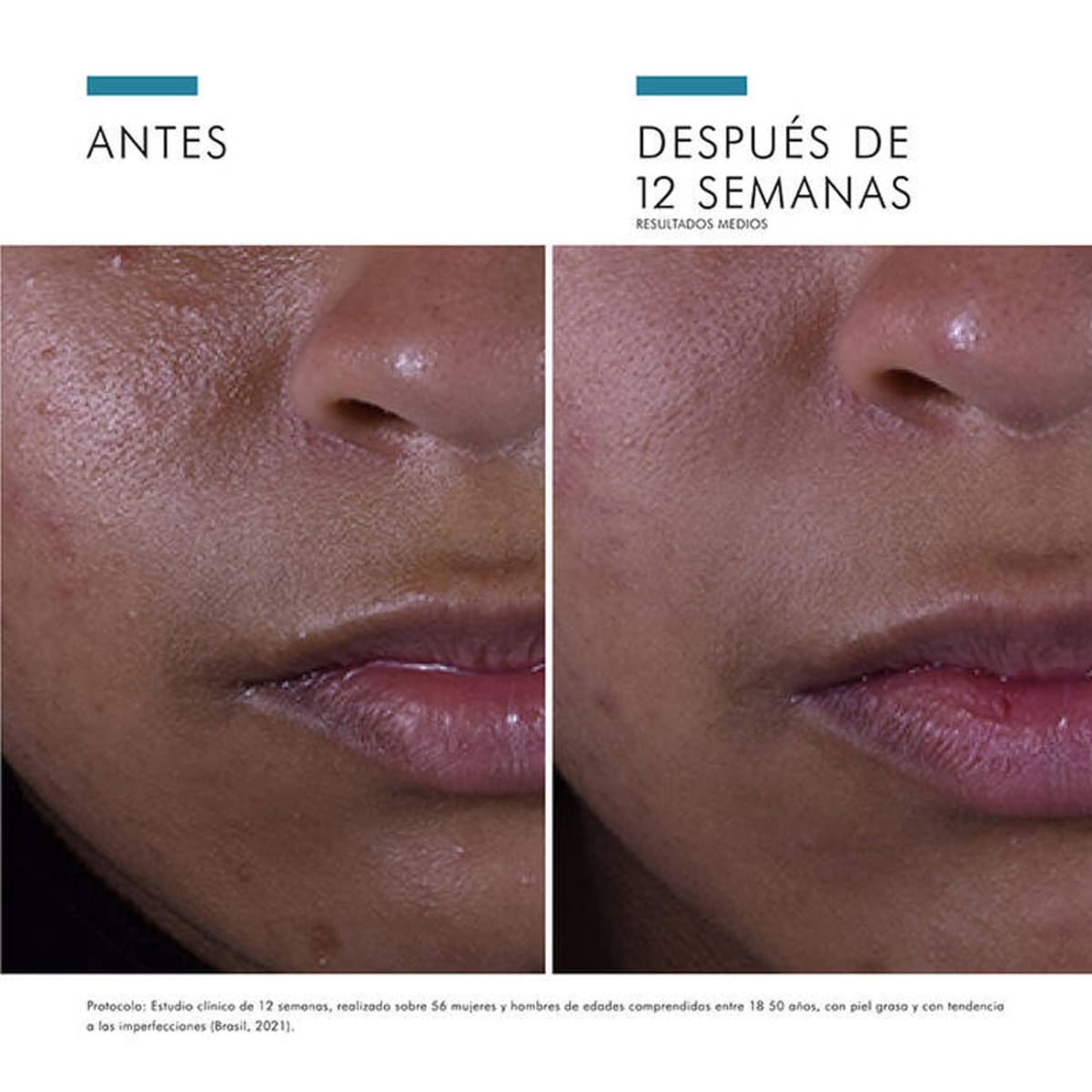 Silymarin CF 30ml - SkinCeuticals5