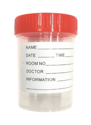 FRASCO MUESTRA DE ORINA1