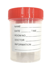 FRASCO MUESTRA DE ORINA