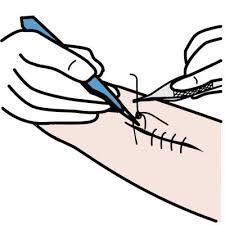 ENFERMERIA DOMICILIARIA - RETIRO DE PUNTOS