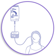 NUTRICIONISTA DOMICILIARIA - NUTRICION ENTERAL