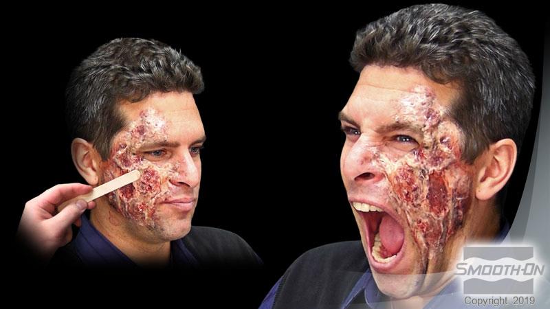 Ultimate Wound Kit™ - Kit Heridas2