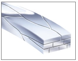 Arco 8- Braided Rectangular,