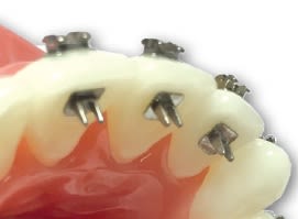  Mini Espolón educador