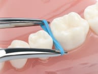 Pinza Porta Elásticos USA.