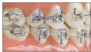 Niti Open Coil Spring