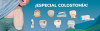 https:  ct ibiocare.bsalemarket.comcolostomia