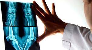 Ortopedia y Traumatologia