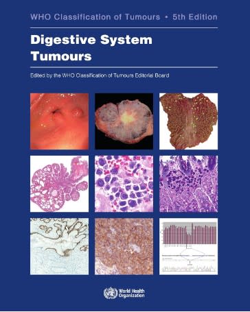 Digestive System Tumours WHO Classification of Tumours | Librería