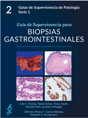 Guia de Supervivencia para Biopsias Gastrointestinales  2ª Ed. - Poveda