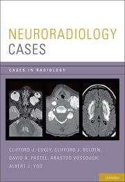 Neuroradiology Cases Clifford J. Eskey1