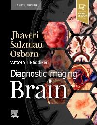Diagnostic Imaging: Brain, 4th Edition1