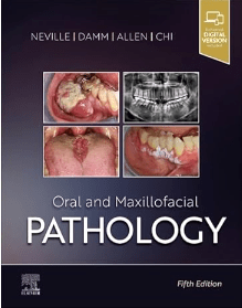 Neville Oral and Maxillofacial Pathology, 5th Edition