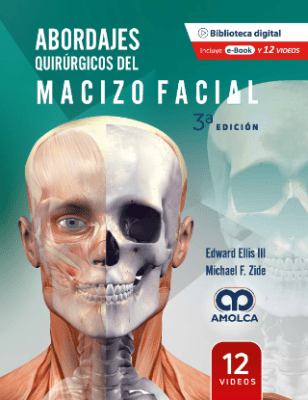 Ellis Abordajes quirurgicos del macizo facial 3° ed.