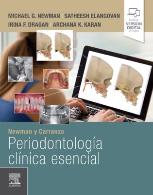 Newman  Carranza Periodontologia Clinica Esencial