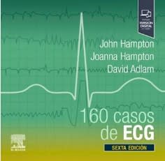 160  CASOS DE ECG HAMPTON1