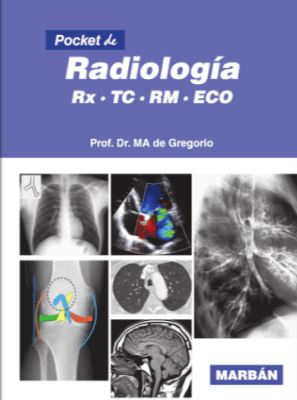 De Gregorio, Pocket de Radiologia 3a ed.