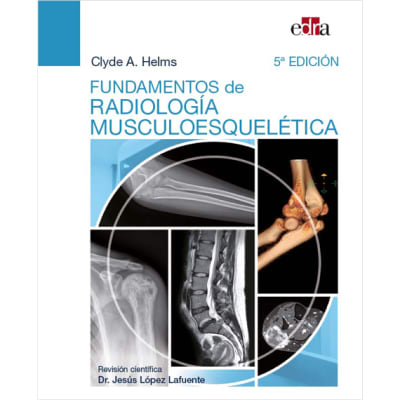 Helms Radiologia Musculoesqueletica
