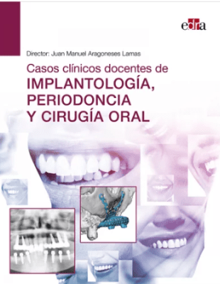 Casos clínicos docentes de implantología, periodoncia y cirugía oral
