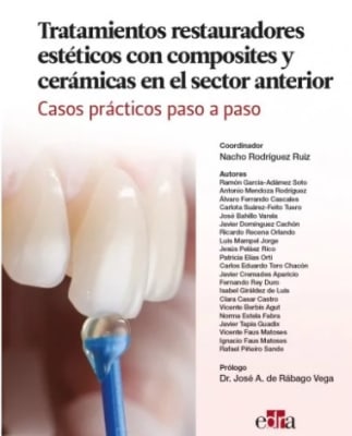 Tratamientos restauradores estéticos con composites y cerámicas en el sector anterior. Casos prácticos