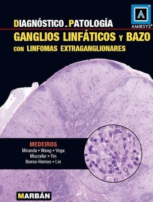 Medeiros Diagnóstico en Patología - Ganglios linfáticos y Bazo