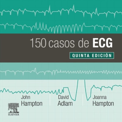 Hampton 150 Problemas De Ecg 5Ed.