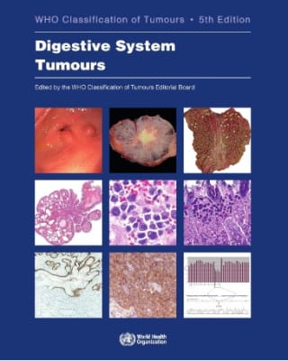 Digestive System Tumours WHO Classification of Tumours1