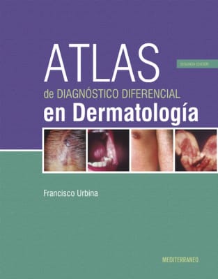 Urbina Atlas De Diagnostico Diferencial En Dermatologia 2Ed.