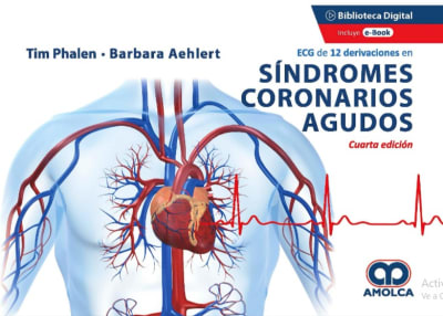 ECG de 12 Derivaciones en Síndromes Coronarios Agudos - Phalen