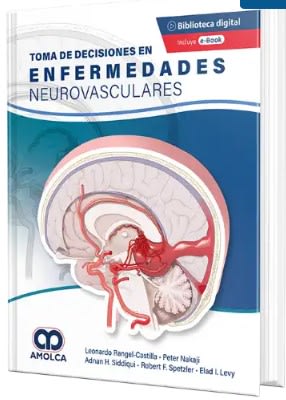 Rangel toma de decisiones en enfermedades neurovasculares