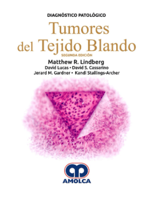 Lindberg tumores del tejido Blando