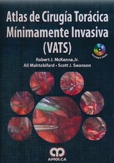McKenna, Atlas de Cirugia Toracica Minimamente Invasiva (VATS)1