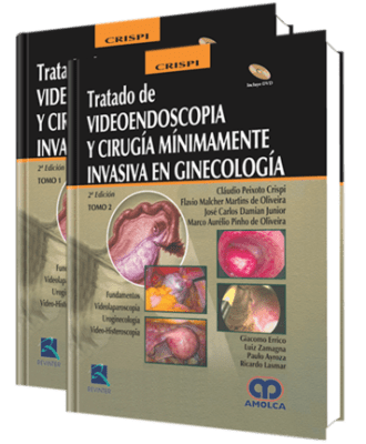 Crispi Peixoto, Tratado de Videoendoscopia y Cirugia Minimamente Invasiva en Ginecologia. 2a Ed. 2 T