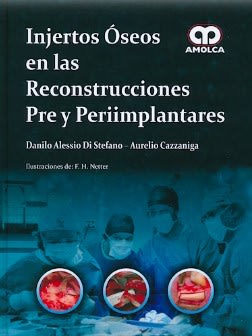 Injertos Óseos en las Reconstrucciones Pre y Periimplantares Di Stefano