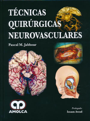 Jabbour  Técnicas Quirúrgicas Neurovasculares