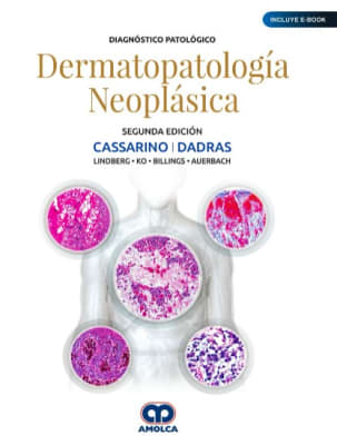 Diagnostico Patologico Dermatopatologia Neoplasica - David Cassarino