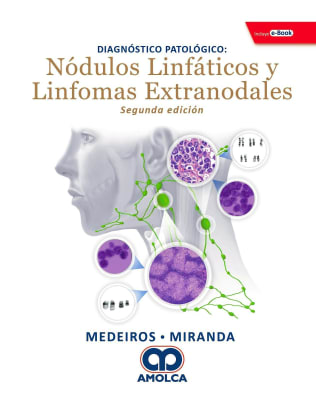 Diagnóstico Patológico. Nódulos Linfáticos y Linfomas Extranodales Medeiros, L. — Miranda, R.