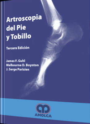Guhl  Artroscopia Del Pie Y Tobillo - amol1
