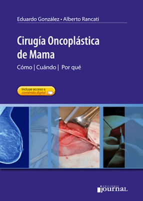 Gonzalez  Cirugia Oncoplastica De Mama