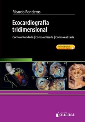 Ronderos, Ecocardiografia Tridimensional1
